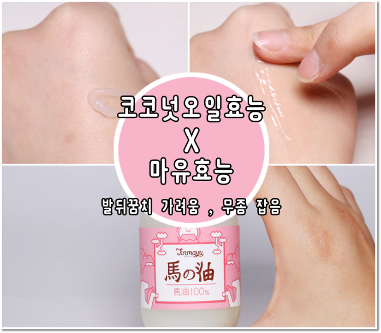  코코넛오일효능 무좀 잡음!+발뒤꿈치 가려움