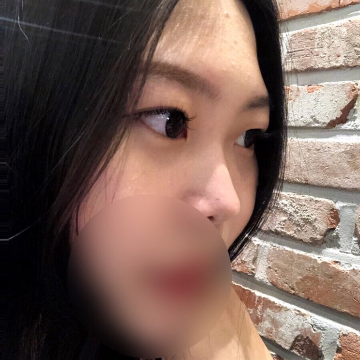  미세모 시술로 자연스러운 눈매 부천 속눈썹 잘하는곳  추천 상동역 호감 HOGAM