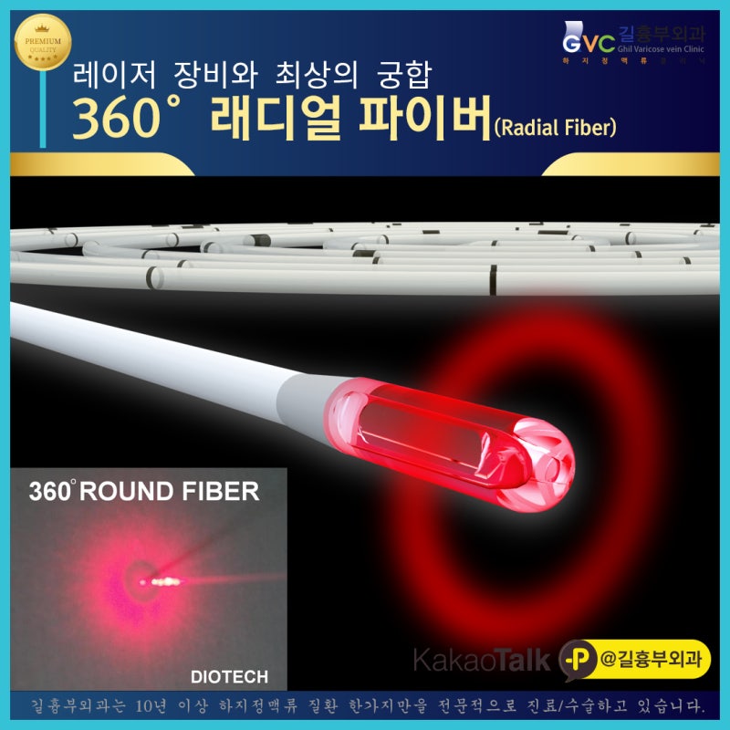 강남흉부외과추천 하지정맥 레이저수술(EVLT) 특징은? 5