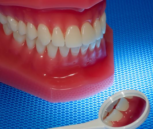 치아미백 어떤 치과에서 어떤 종류로 하는게 좋나요?