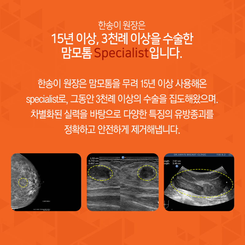 가슴혹수술 맘모톰으로 안전하게 제거해