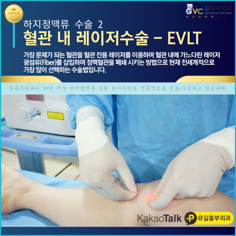 강남흉부외과추천 하지정맥 레이저수술(EVLT) 특징은?