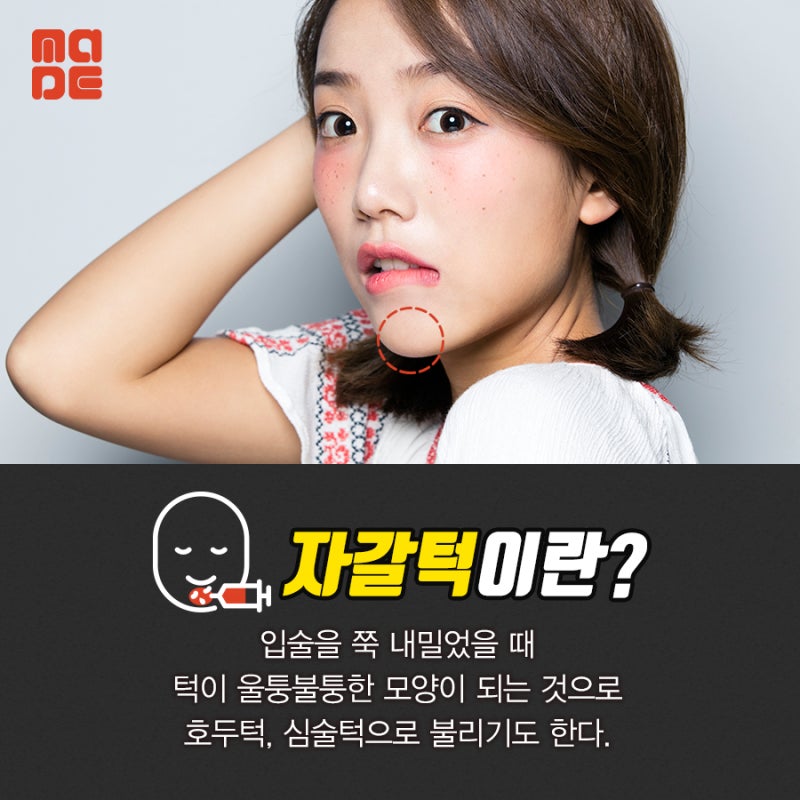 자갈턱 보톡스 원리와 효과를 알아보자! : 네이버 블로그