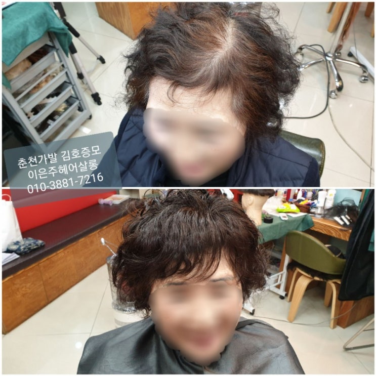  탈모고민으로 알아본 여성탈모의 원인과증상 춘천가발 김호증모 부분탑가발로 해결했어요~~^^