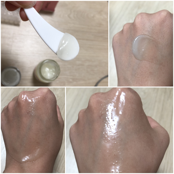  여드름흉터연고 턱 화농성 + 노스카나겔 부작용