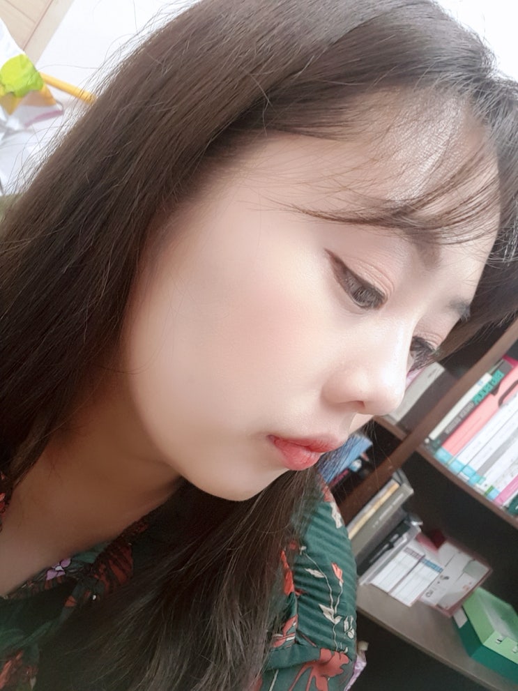  NS 안면윤곽주사 전후 얼굴지방분해주사 3회차 후기!