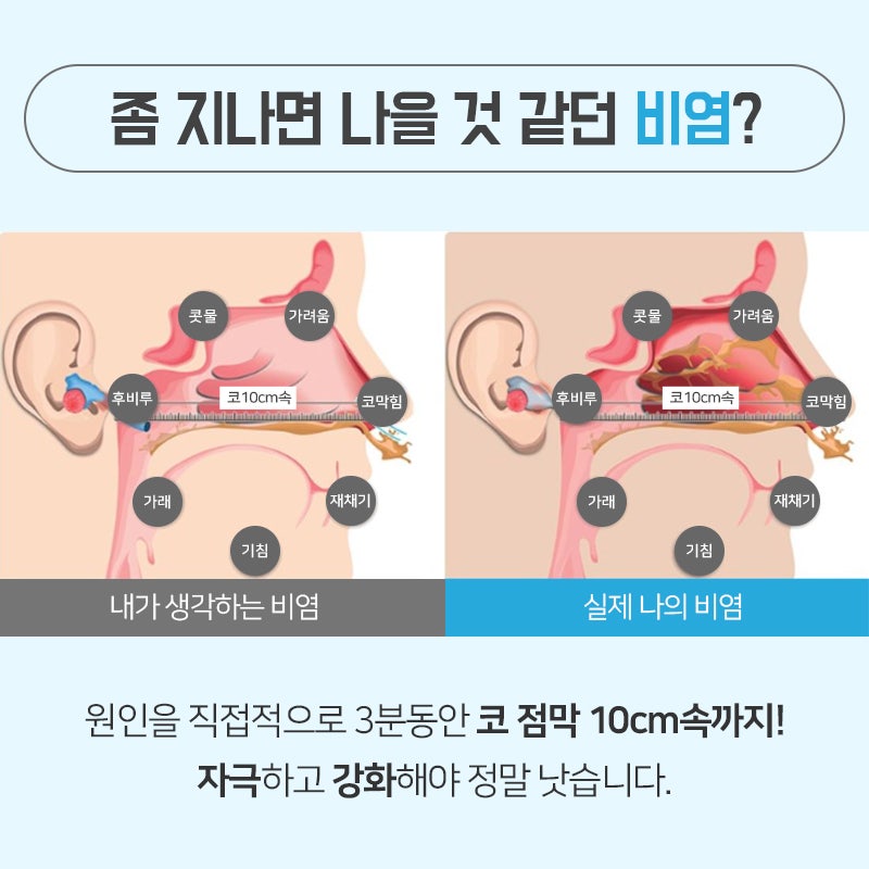 분당 비염 한의원 점막 기능을 강화하는 치료로