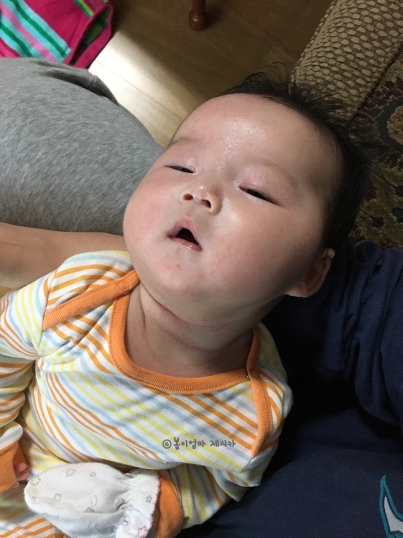 돌 이후 많이 좋아진 아기 얼굴 피부 (아토피/침구/피부염/보습제 리뷰) 6