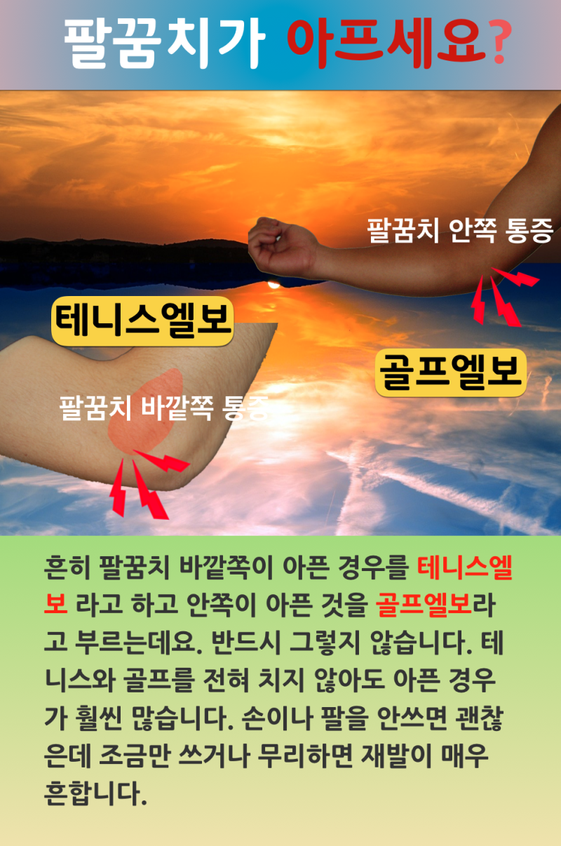 대구테니스 엘보 증상에 맞는 치료법 3