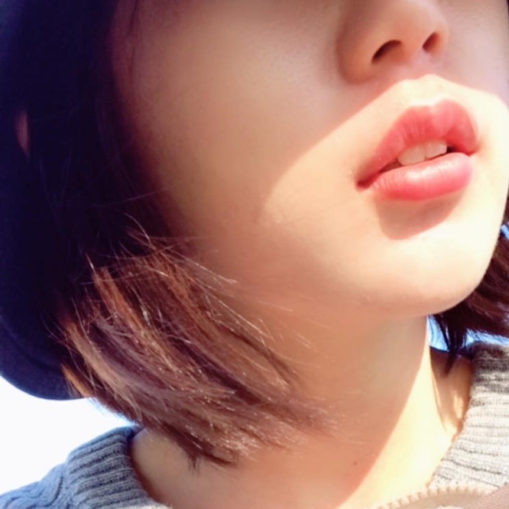  여드름흉터연고x콕콕앰플 여드름흉터 제거 효과 봄!