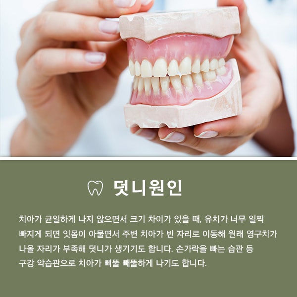 수원 추천치과 차이점 비교