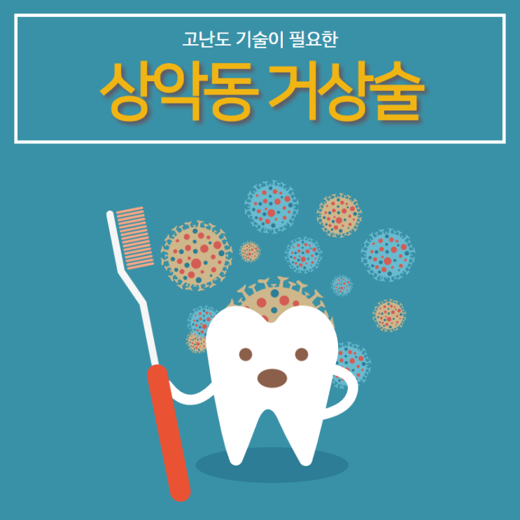  고난도 기술이 필요한 상악동 거상술