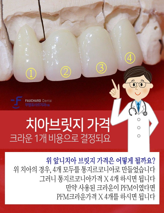 치아 브릿지 가격, 아직 비용만 보고 병원을 선택하시겠습니까?
