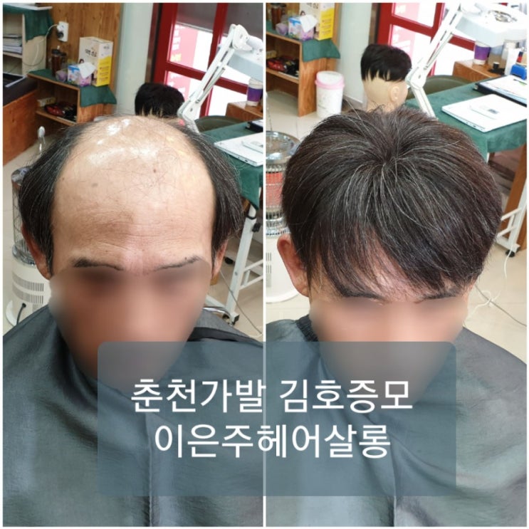  춘천가발 김호증모 남성탈모 비상구 가발!!  의복이라 할 수 있는 패션의 마침표.