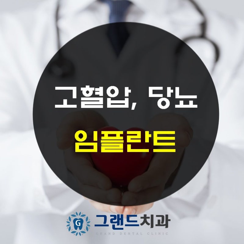 당뇨 고혈압 환자의 전체임플란트수술도 수면 의식하진정법을 통해 네비게이션 및 원데이로 편안하게 강동구 천호동임플란트 치과
