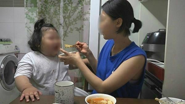  로하드 증후군 증상은?
