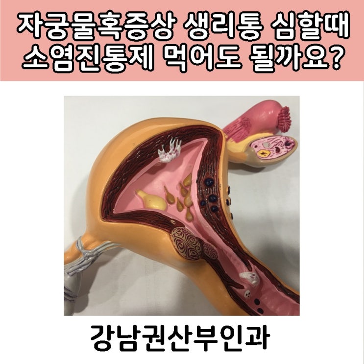  자궁물혹증상 생리통 심할때 소염진통제 먹어도 될까요?
