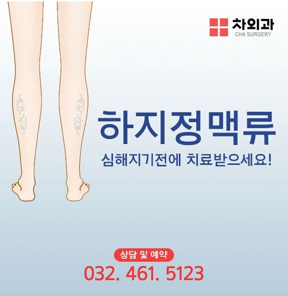 인천하지정맥, 남동구 하지정맥은 인천차외과!