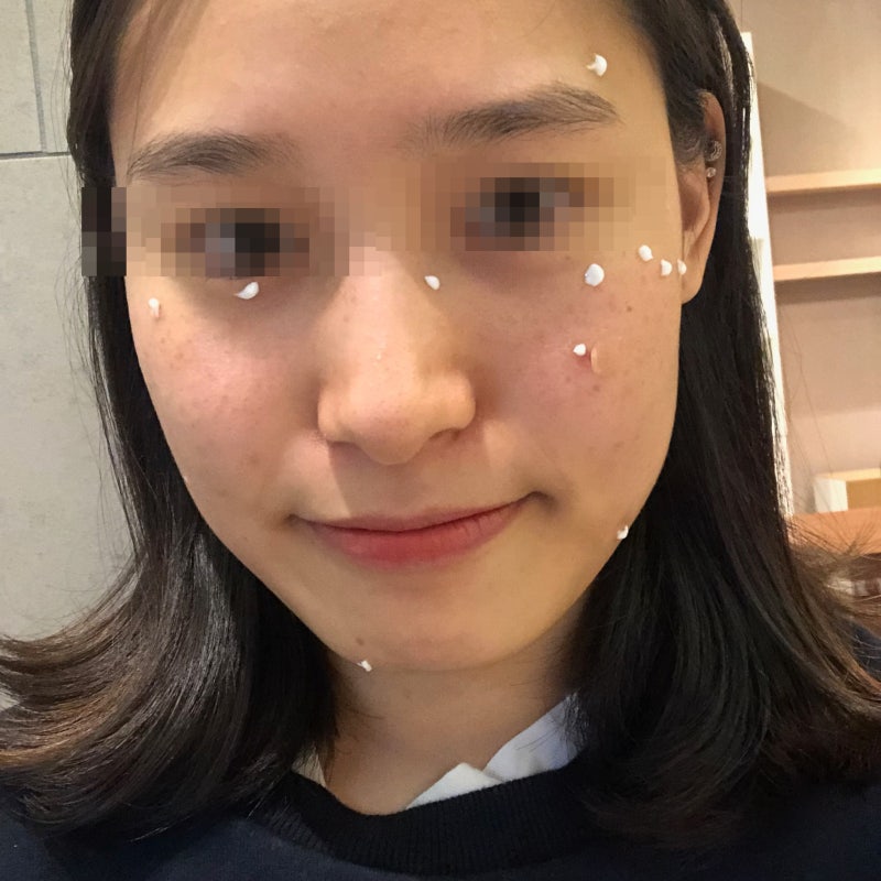 점을 제거하고 재생 크림을 빠르게 회복하는 요령 8