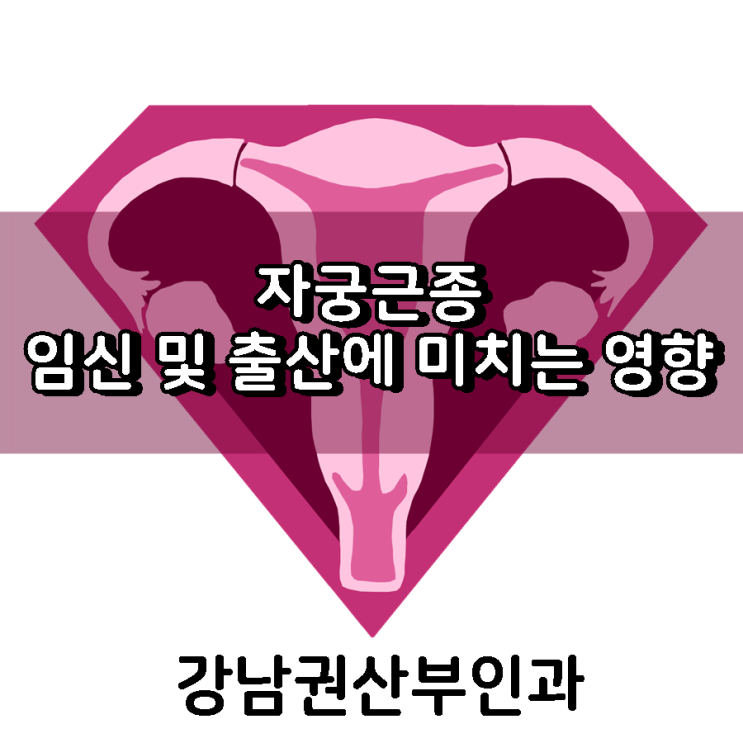  자궁근종 임신 및 출산에 어떤 영향을 미치나요?