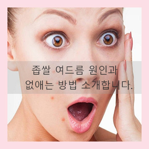  좁쌀여드름 원인과 없애는 방법