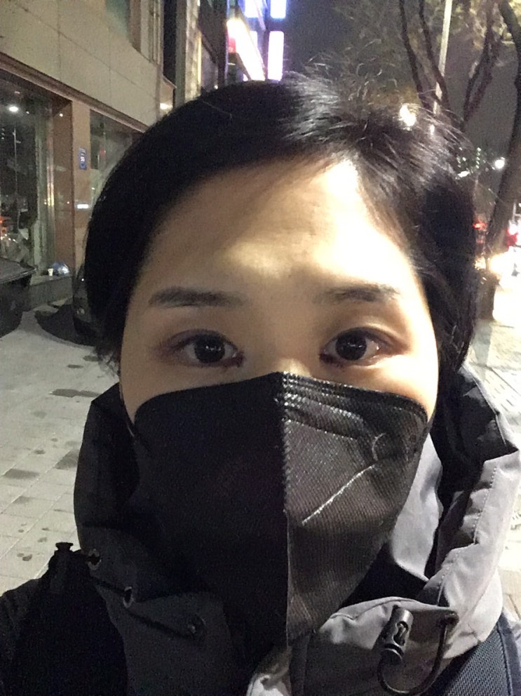  리얼 쌍수후기 | 수술 0일차, 비절개 눈매교정 + 윗트임 쌍꺼풀, 안검하수 몽고주름