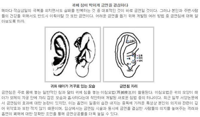  이(耳)침과 금연침에 관해