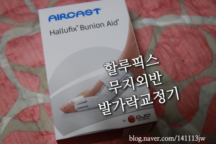 발가락 교정기- 할루픽스 무지외반 발가락 교정기 사용후기