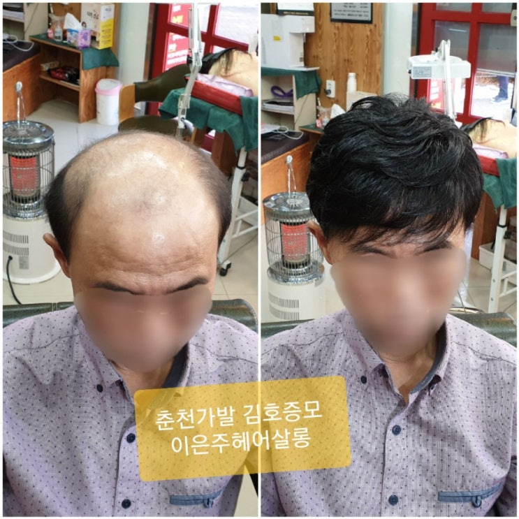  춘천가발 김호증모 남자맞춤가발 사후관리잘하는곳 추천해 주세요~^^