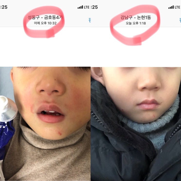  아토피피부 / 건선피부 / 모공각화증 / 습진 / 피부염증 / 아기크림 / 성인아토피 > 아토피협회장이 만든 크림 “바이더닥터”