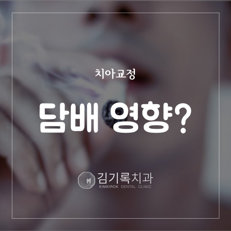 수원치아교정치과 치아교정할 때 담배를 피워도 괜찮을까요? 치아교정 흡연 여부