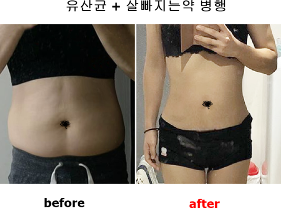  모유유산균 BNR17 vs 셀티바프로바이오틱다이어트 -10kg
