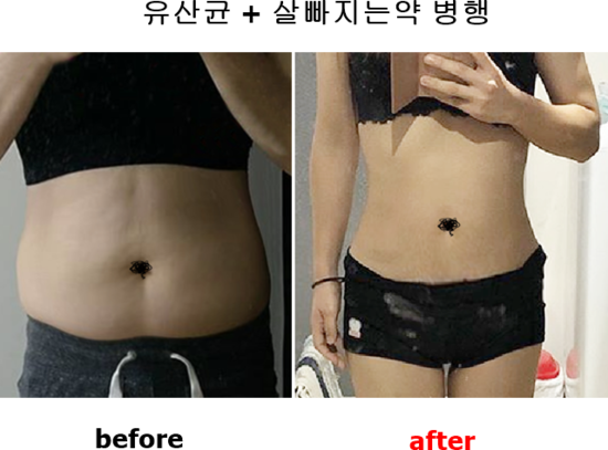 모유유산균 BNR17 vs 셀티바프로바이오틱다이어트 -10kg