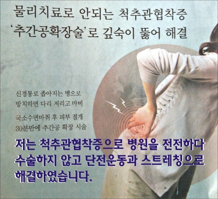 저는 척추관협착증으로 병원을 전전하다 수술하지 않고 단전호흡으로 해결하였다.