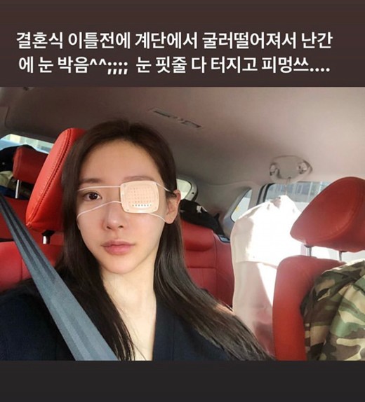 [송다예] 김상혁송다예 커플, 오늘 결혼식을 올려! 송다예는 다친 눈에 대해서 해명!