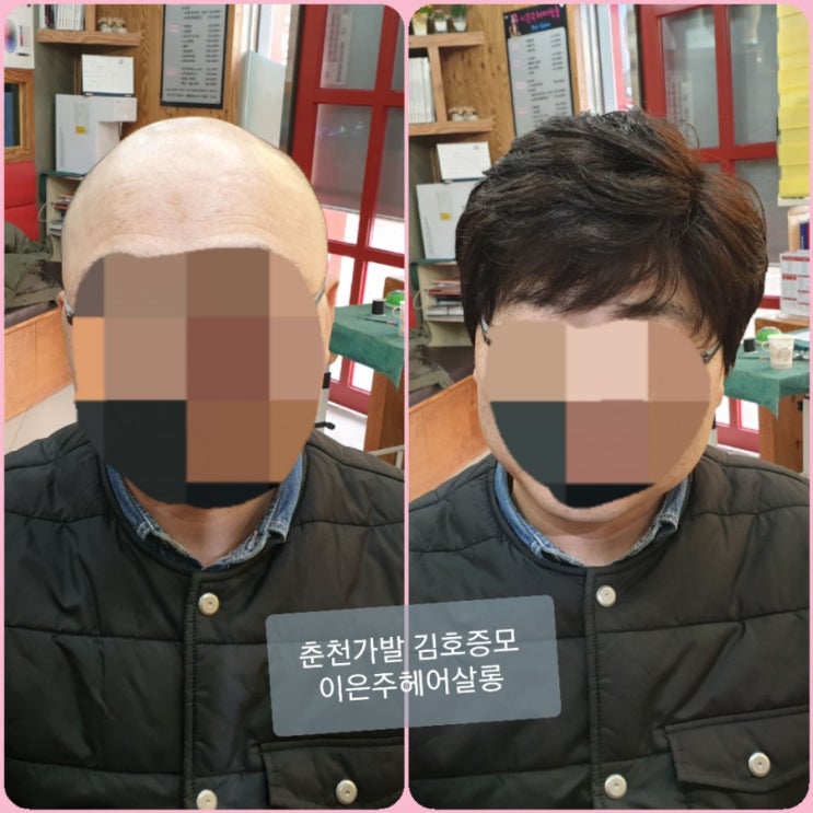  남자전체가발 되나요? 춘천가발 김호증모 이은주헤어살롱은 가발전문샵으로 가발의 모든 것이 준비되어 있습니다~^^