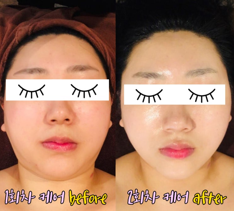 청주 피부관리 신부관리 선에스테스파에서 두번째 케어! 청주 피부관리 신부관리 선에스테스파에서 두번째 케어!