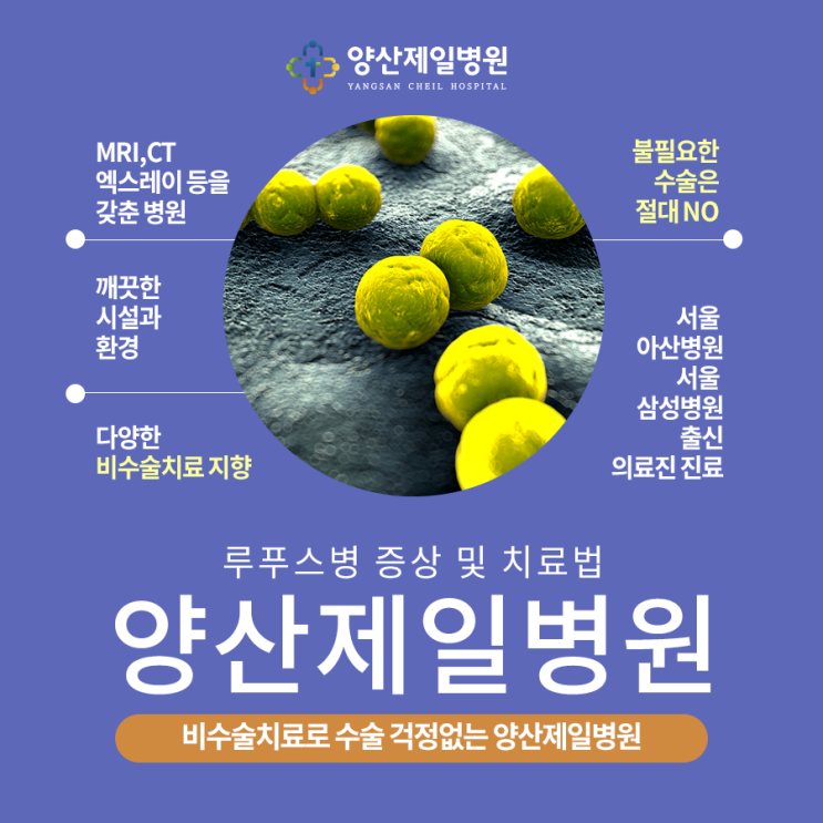  루푸스병 제대로 치료하고 있습니다