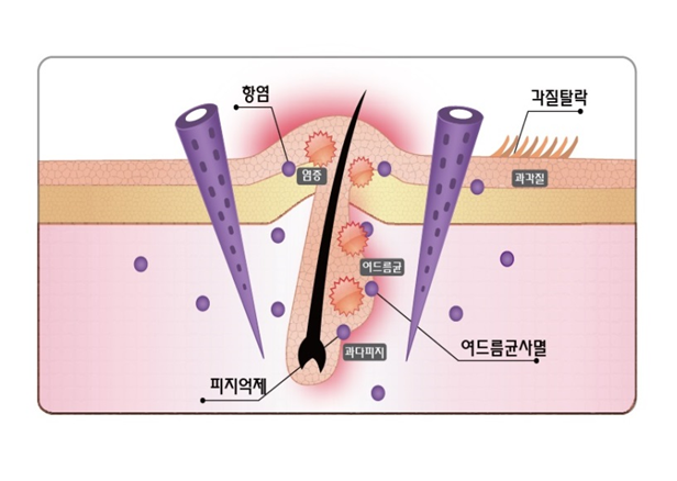 스피큘 효과 체크 & 리르 스피큘 스팟 세럼 후기 (모공 잡티 케어) 3