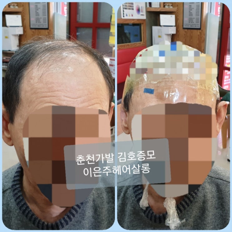 서울까지 갈필요 있나요? 춘천가발전문점 이은주헤어살롱 남자맞춤가발 본뜨기 합니다~^^