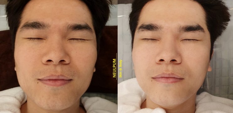  쌍문역 피부샵 :: 골드테라피  연예인피부관리 개그맨윤성한 이 떴다!