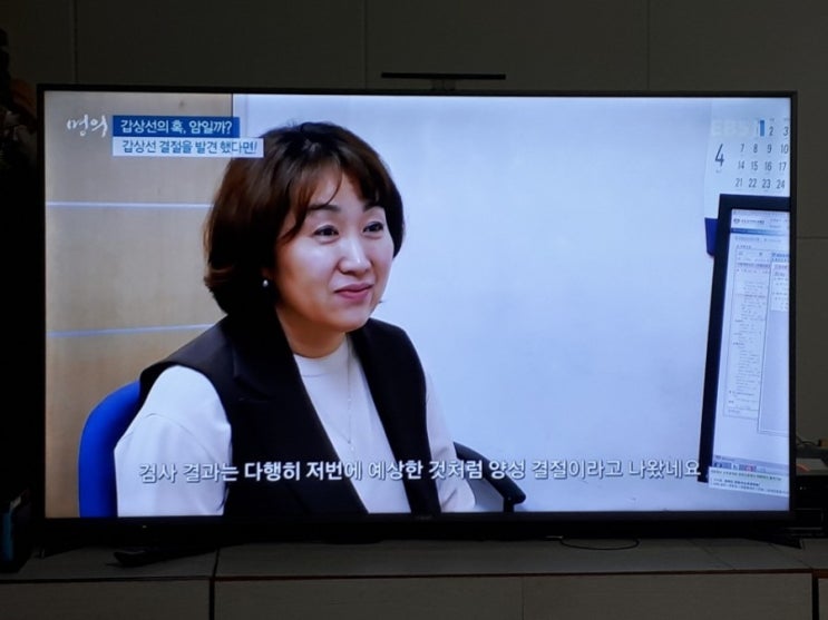  명의 혹 암일까 갑상선  황진증