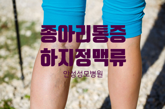  [안성외과]종아리 통증 및 저림, 하지정맥류 병원치료 해야_도움말.안성성모병원 황준영 진료부장