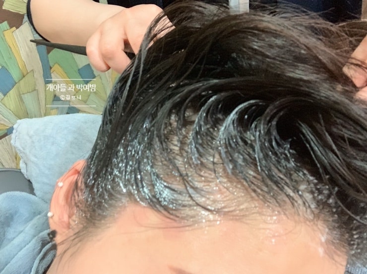 울산탈모클리닉 두피가 비어보이는게 느껴지기 시작하면