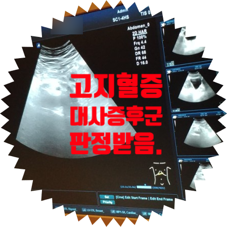  고지혈증 대사증후군 고혈압 공복혈당장애 간기능저하 판정 이후 앞으로의 건강관리 계획