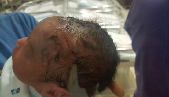 분당차병원 분망 중 아이 떨어뜨려 사망, 양심이 사망한 의사
