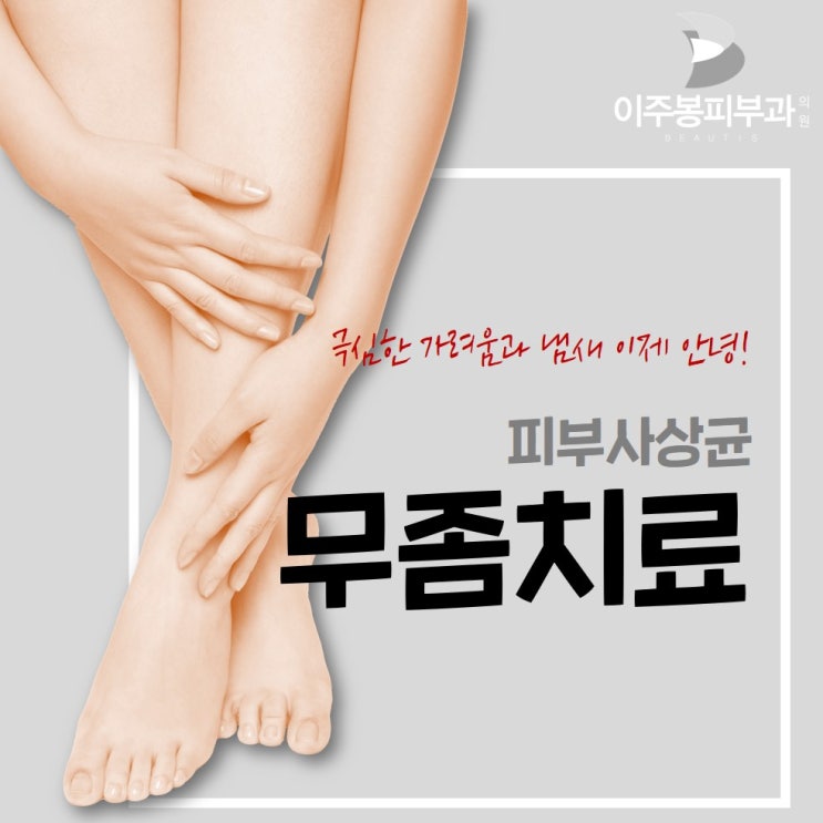  수원 이주봉피부과 , 피부사상균 무좀치료 !