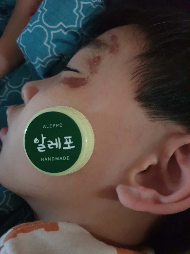  아가솝.조향알레포밤 아이상처에 굿