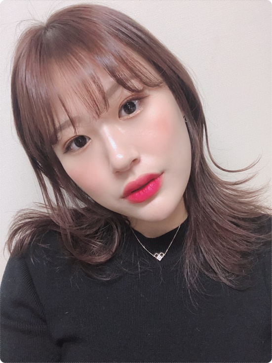  무턱필러전후 톡스미 무턱필러 / 텍사스데브라질 후기