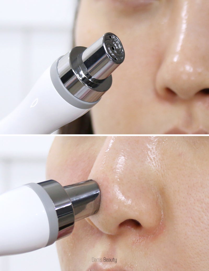 집에서 하는 아쿠아필 디바이스 ☆ 엔시트론 아쿠아바이탈케어 : 네이버 블로그